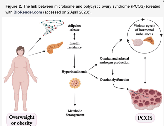 多嚢胞性卵巣症候群と肥満の関連性を示す図