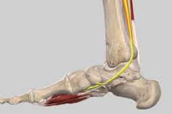 学芸大学整体院office-kの勝俣英明院長が担当した重度のふくらはぎ痛の解説画像
