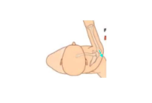 学芸大学カイロプラクティックoffice-kの勝俣院長による巻き肩ゴルファーの肩関節後方変位に対するカイロプラクティック治療の説明画像